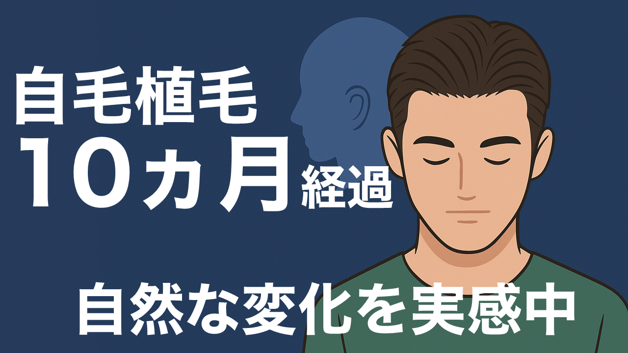 自毛植毛10ヶ月経過　自然な変化を実感中